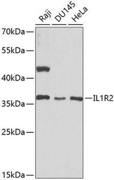 Anti-IL-1R2 Antibody (CAB1899)