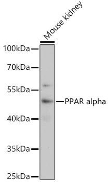 Anti-PPAR alpha Antibody (CAB3123)