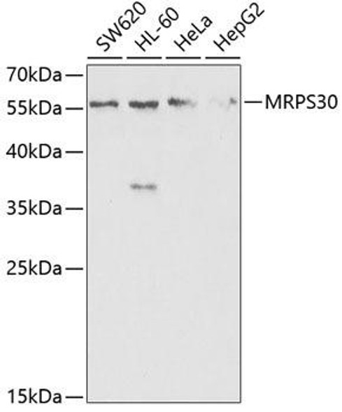 Anti-MRPS30 Antibody (CAB5841)