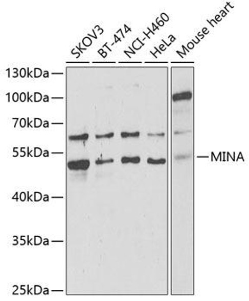 Anti-MINA Antibody (CAB6655)