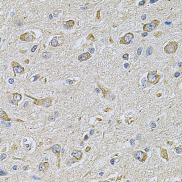 Anti-FASTKD1 Antibody (CAB7384)