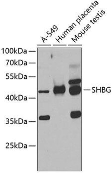 Anti-SHBG Antibody (CAB7450)