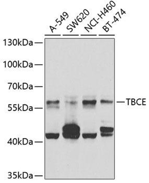 Anti-TBCE Antibody (CAB7453)