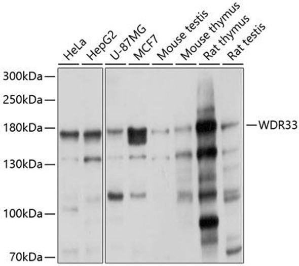 Anti-WDR33 Antibody (CAB9531)