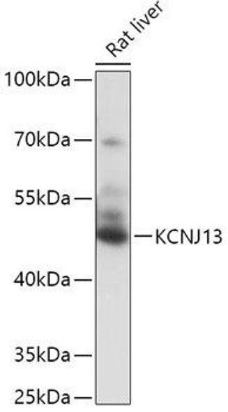 Anti-KCNJ13 Antibody (CAB17505)
