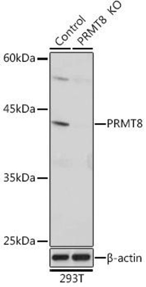 Anti-PRMT8 Antibody (CAB18440)[KO Validated]