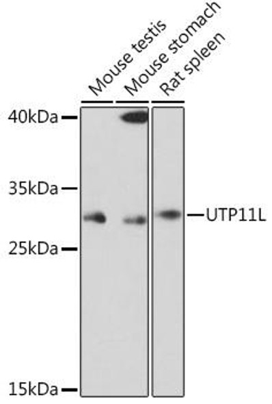 Anti-UTP11L Antibody (CAB18455)