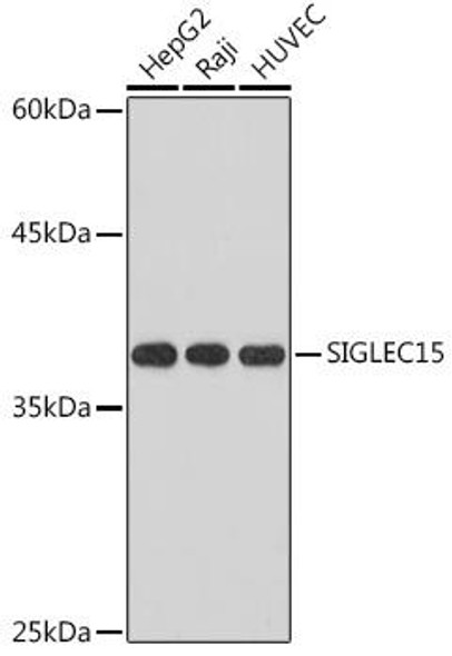 Anti-SIGLEC15 Antibody (CAB18660)