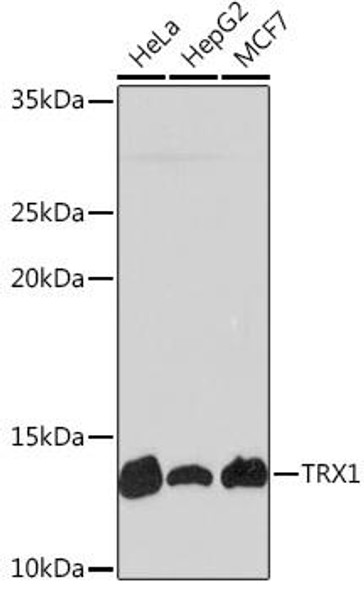 Anti-TRX1 Antibody (CAB4024)