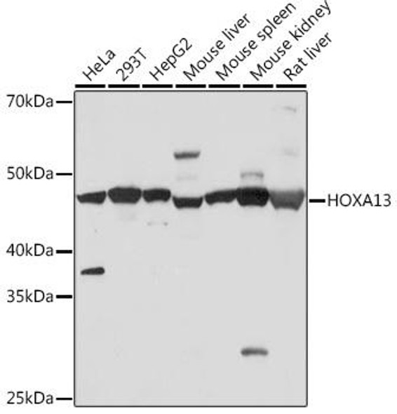Anti-HOXA13 Antibody (CAB9564)
