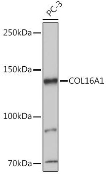 Anti-COL16A1 Antibody (CAB18837)