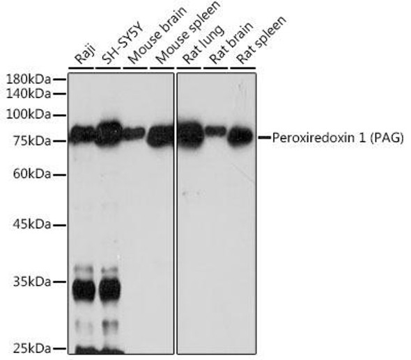 Anti-Peroxiredoxin 1 (PAG) Antibody (CAB19273)