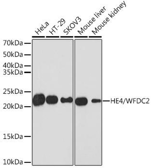 Anti-HE4/WFDC2 Antibody (CAB3276)