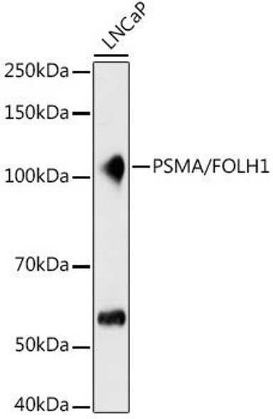 Anti-PSMA/FOLH1 Antibody (CAB9547)