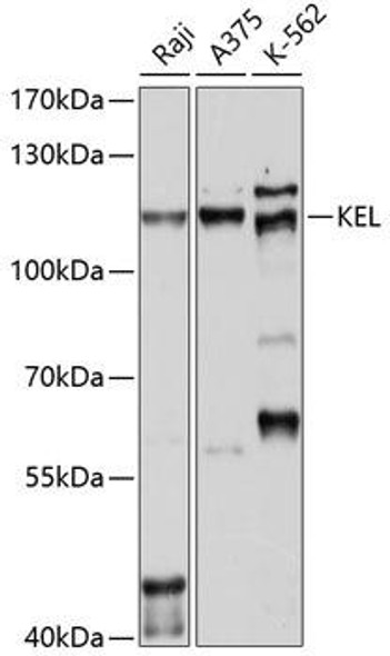Anti-KEL Antibody (CAB10116)