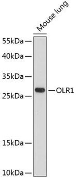 Anti-OLR1 Antibody (CAB12060)
