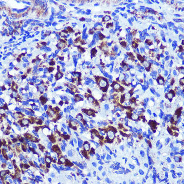 Anti-PALLD Antibody (CAB12362)