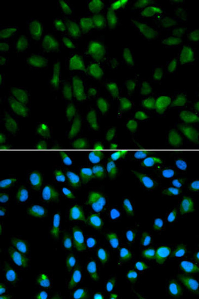 Anti-PSMA3 Antibody (CAB1245)