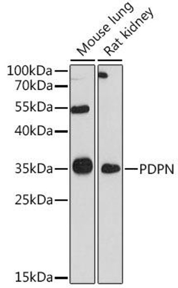 Anti-PDPN Antibody (CAB13261)