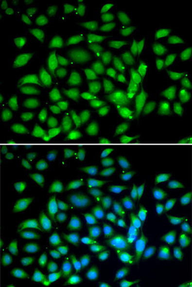 Anti-MECP2 Antibody (CAB13328)