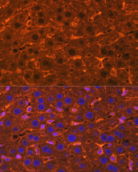 Anti-Ceruloplasmin Antibody (CAB13660)