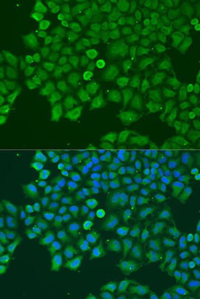 Anti-CAST Antibody (CAB13683)