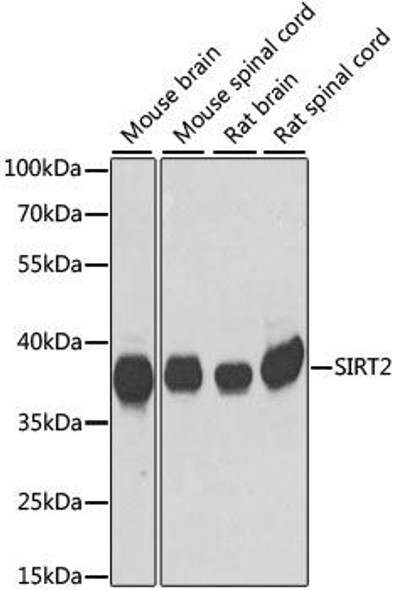 Anti-SIRT2 Antibody (CAB14109)