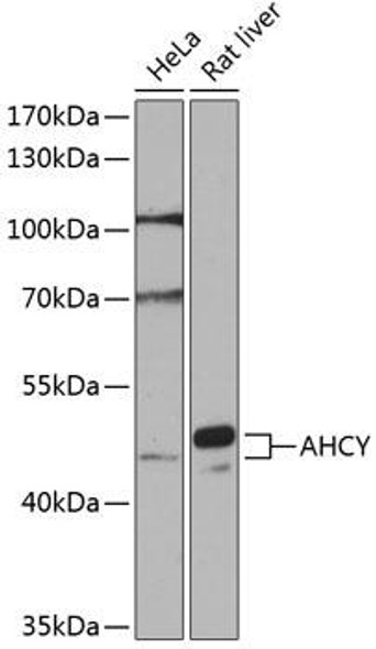 Anti-AHCY Antibody (CAB14182)