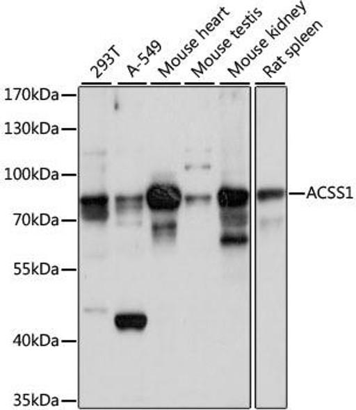 Anti-ACSS1 Antibody (CAB15007)
