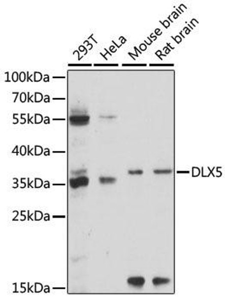 Anti-DLX5 Antibody (CAB15049)