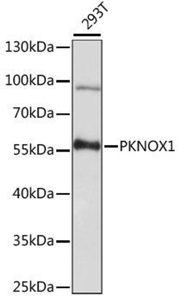 Anti-PKNOX1 Antibody (CAB15301)