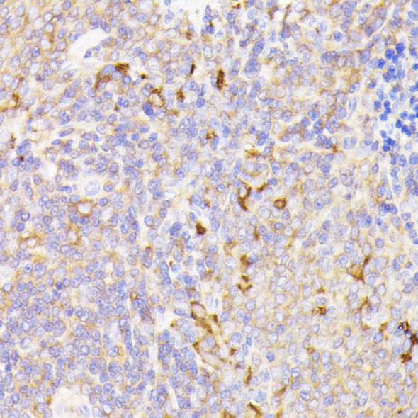 Anti-PSMG1 Antibody (CAB15339)