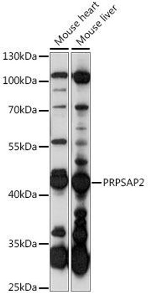 Anti-PRPSAP2 Antibody (CAB15711)