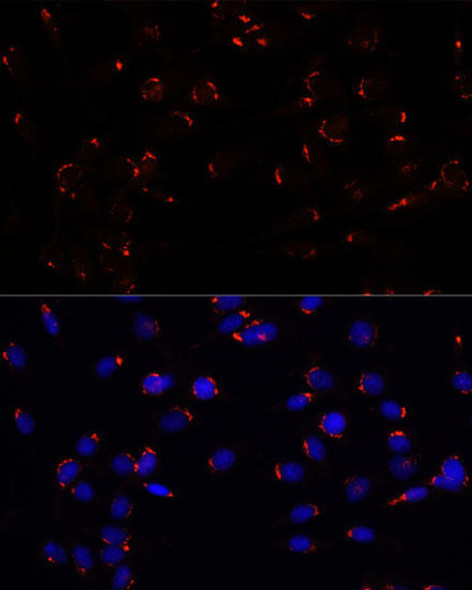 Anti-GOLGA5 Antibody (CAB15768)