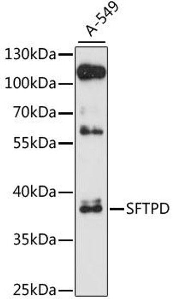 Anti-SFTPD Antibody (CAB1651)