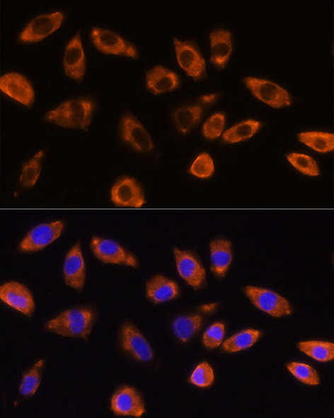 Anti-GNB1 Antibody (CAB1867)