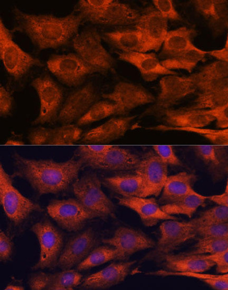 Anti-MALT1 Antibody (CAB2144)