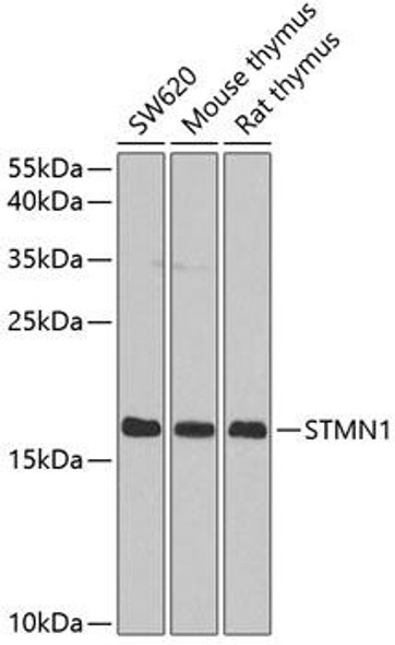 Anti-STMN1 Antibody (CAB2176)