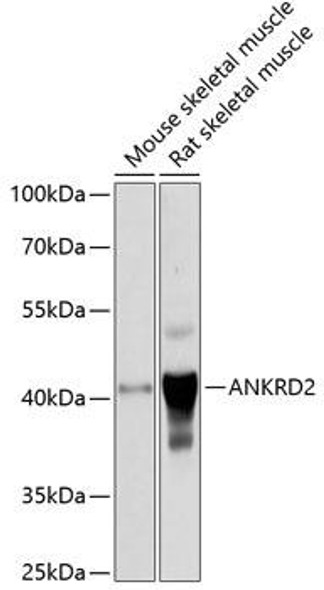 Anti-ANKRD2 Antibody (CAB4622)