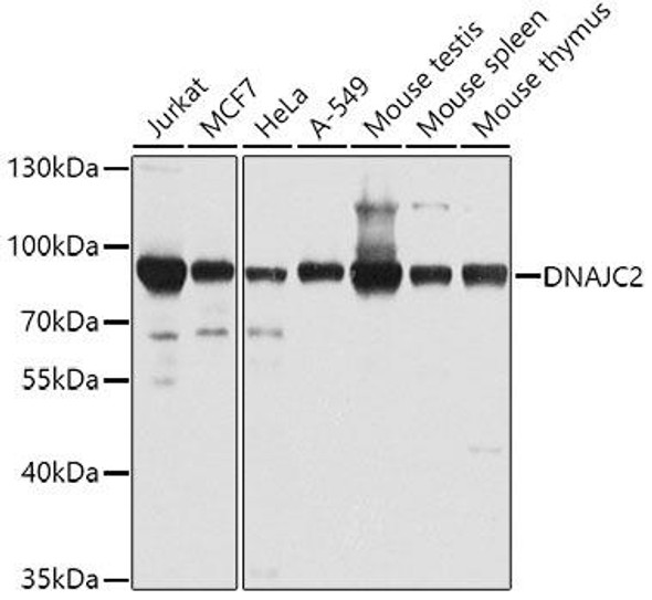 Anti-DNAJC2 Antibody (CAB4633)