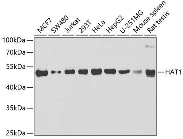 Anti-HAT1 Antibody (CAB6188)