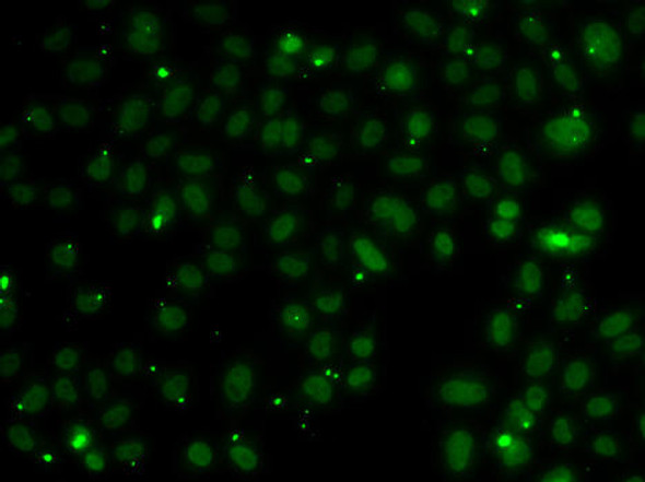 Anti-NSL1 Antibody (CAB7089)