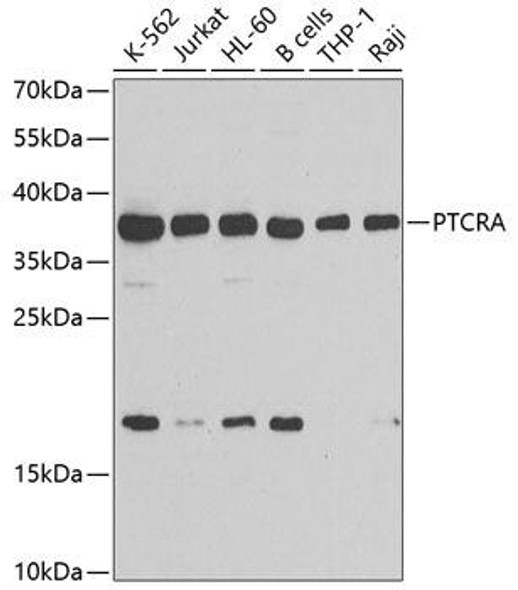 Anti-PTCRA Antibody (CAB7150)