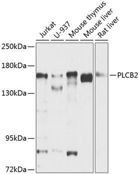 Anti-PLCB2 Antibody (CAB8141)