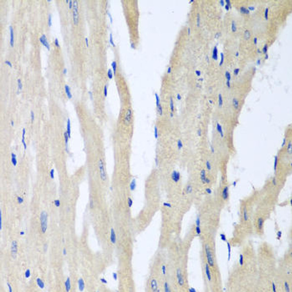 Anti-PITRM1 Antibody (CAB8362)