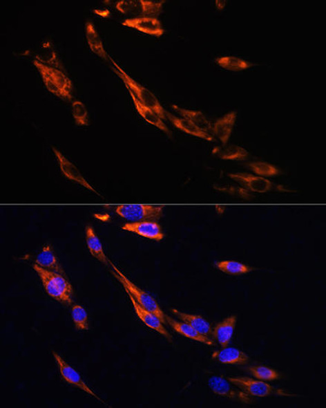 Anti-ADRB3 Antibody (CAB8607)