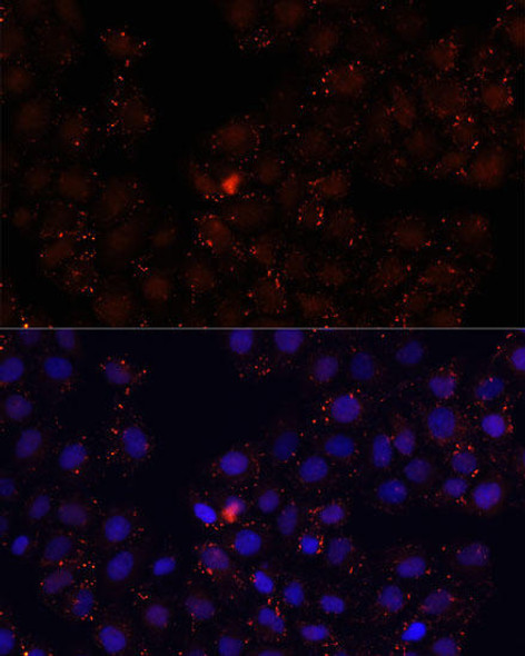 Anti-WDR81 Antibody (CAB12780)