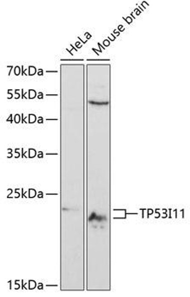 Anti-TP53I11 Antibody (CAB12855)