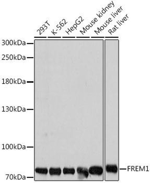 Anti-FREM1 Antibody (CAB16603)