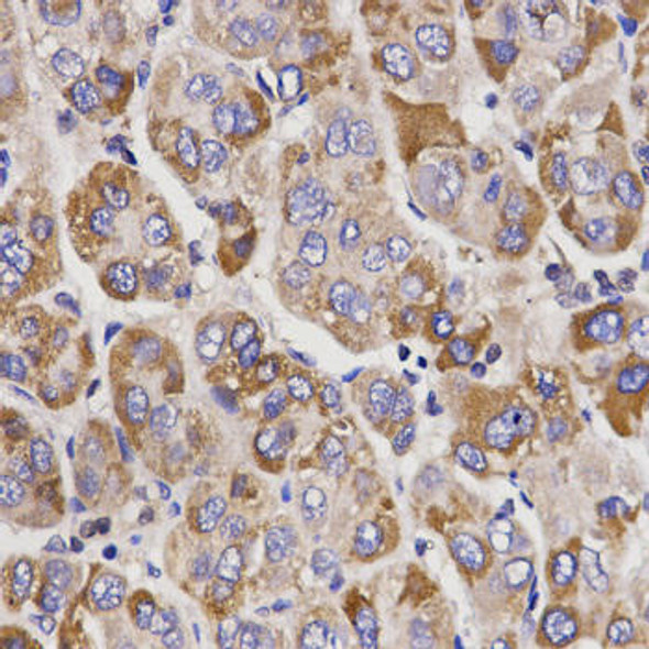 Anti-UGT1A9 Antibody (CAB1661)